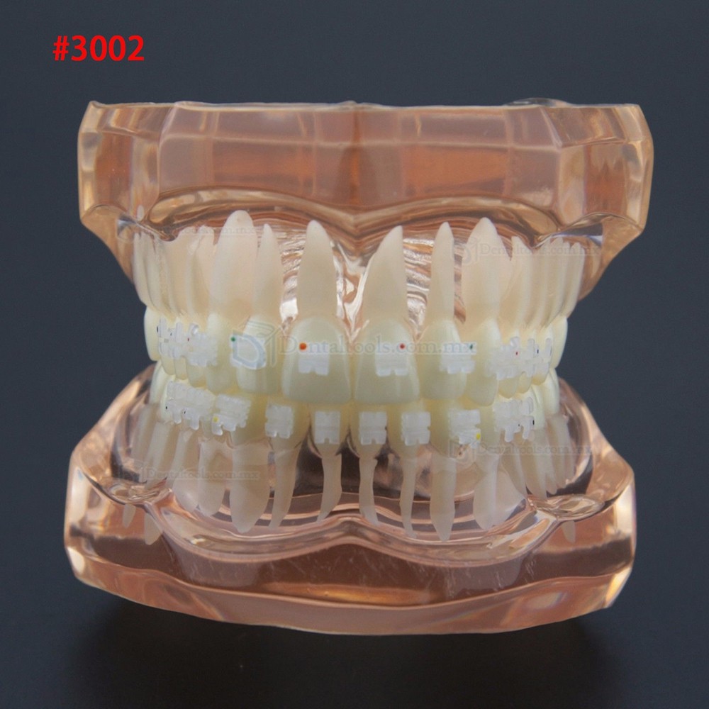 Modelo dental didáctico para demostración y práctica de ortodoncia Modelo dental didáctico para demostración y práctica de ortodoncia