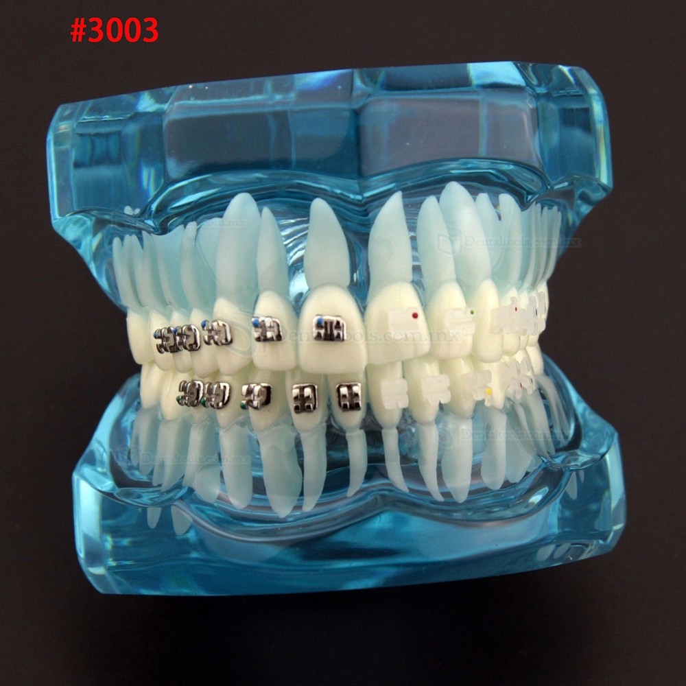 Modelo dental didáctico para demostración y práctica de ortodoncia Modelo dental didáctico para demostración y práctica de ortodoncia
