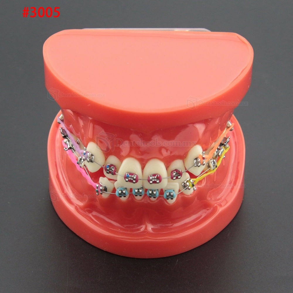 Modelo dental didáctico para demostración y práctica de ortodoncia Modelo dental didáctico para demostración y práctica de ortodoncia