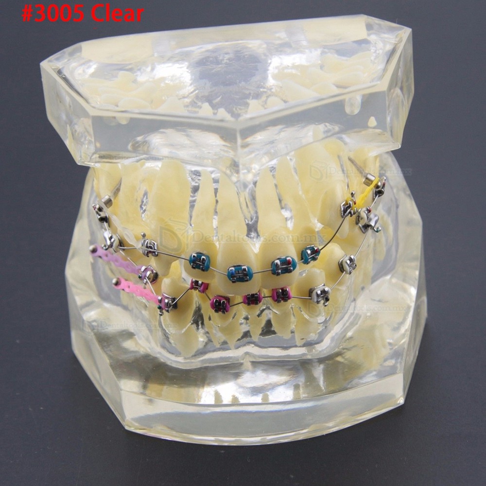 Modelo dental didáctico para demostración y práctica de ortodoncia Modelo dental didáctico para demostración y práctica de ortodoncia
