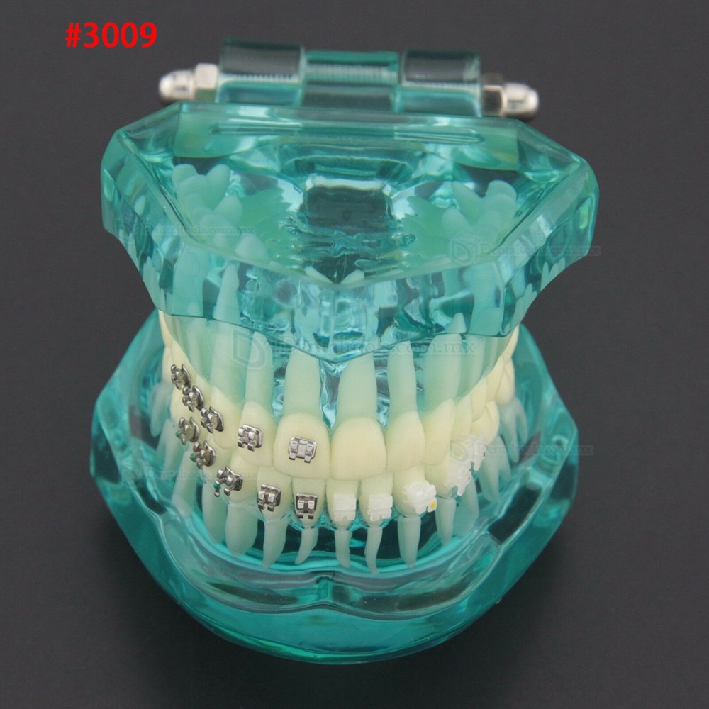 Modelo dental didáctico para demostración y práctica de ortodoncia Modelo dental didáctico para demostración y práctica de ortodoncia