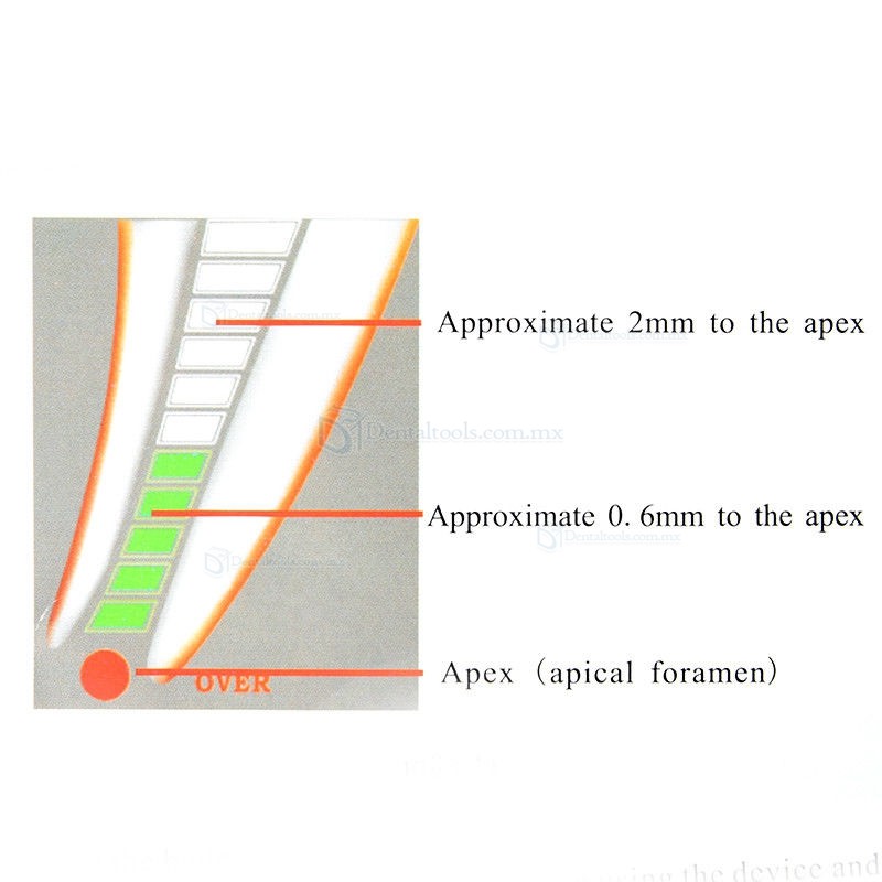 Nuevo 4.5 LCD DentalLocalizadores de apices de endodoncia Apex Localizadores de apices RPEX 6