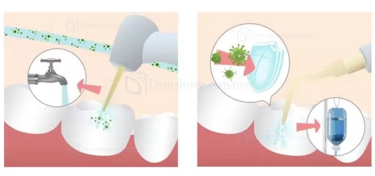 Refine MaxSurgery Unidad de piezocirugía dental Sistema de cirugía ósea piezoeléctrica ultrasónica