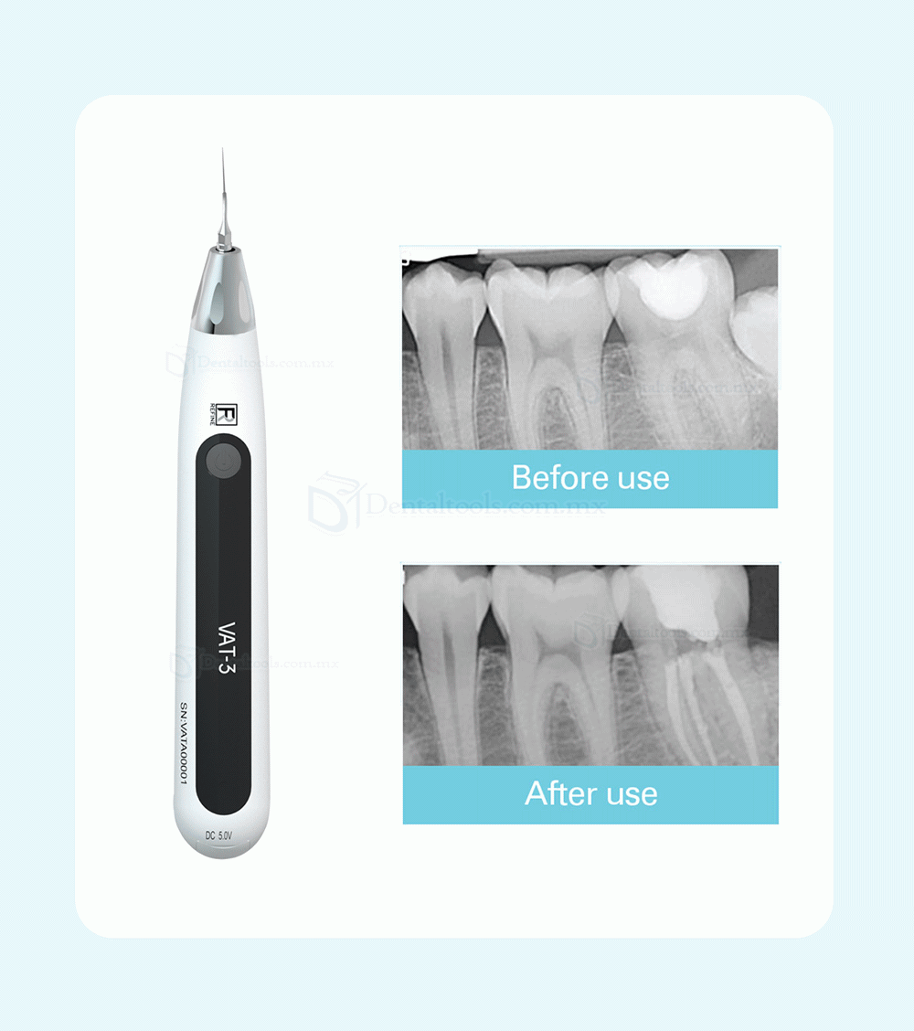 REFINE VAT-3 Activador ultrasónico endodóntico dental Irrigador de conducto radicular inalámbrico