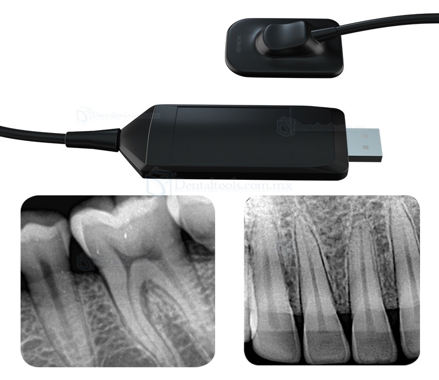 Refine VeRay Máquina de rayos x dental portátil + sensor intraoral RVG