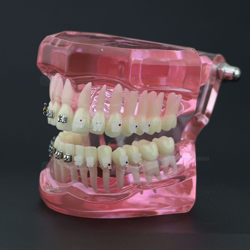 Modelo de ortodoncia con brackets metálicos y cerámicos para enseñanza 3003 Modelo de ortodoncia con brackets metálicos y cerámicos para enseñanza 3003