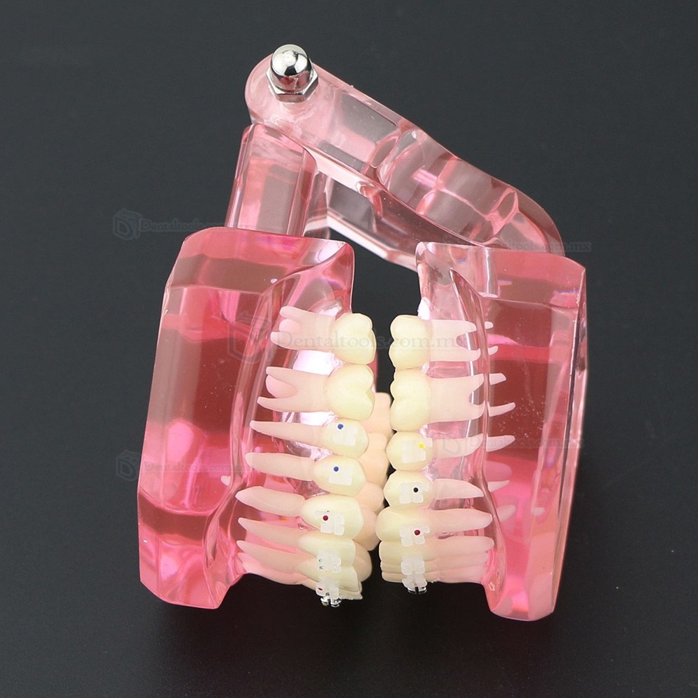 Modelo de ortodoncia con brackets metálicos y cerámicos para enseñanza 3003 Modelo de ortodoncia con brackets metálicos y cerámicos para enseñanza 3003