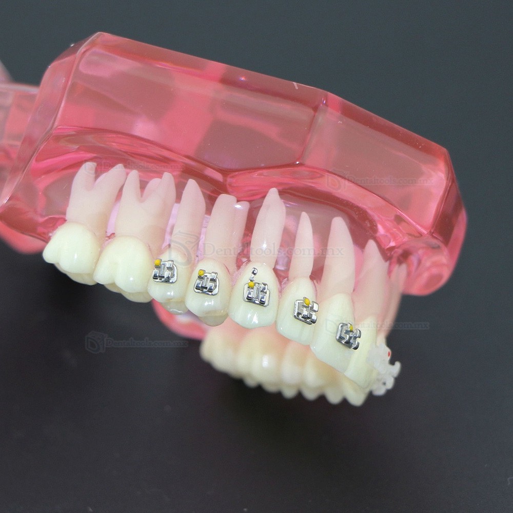 Modelo de ortodoncia con brackets metálicos y cerámicos para enseñanza 3003 Modelo de ortodoncia con brackets metálicos y cerámicos para enseñanza 3003