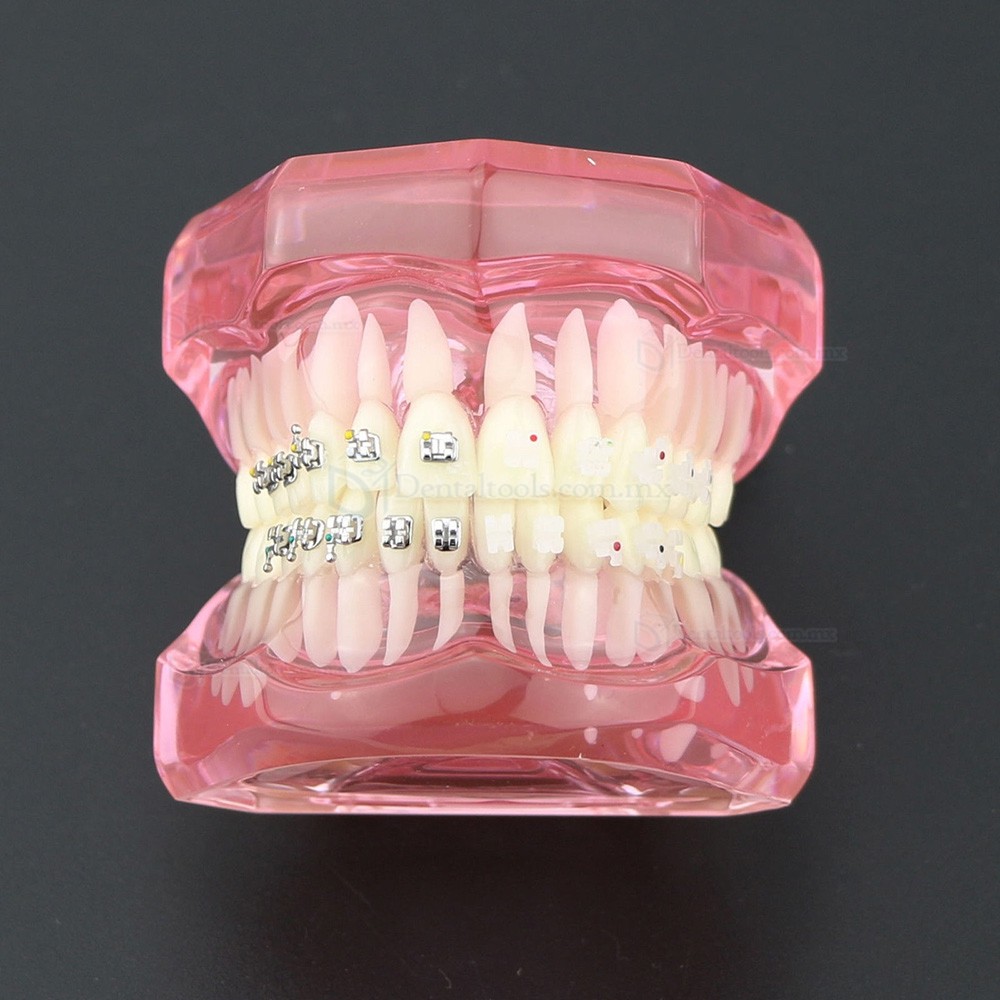 Modelo de ortodoncia con brackets metálicos y cerámicos para enseñanza 3003 Modelo de ortodoncia con brackets metálicos y cerámicos para enseñanza 3003