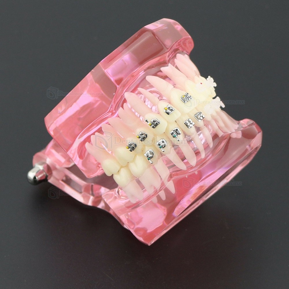 Modelo de ortodoncia con brackets metálicos y cerámicos para enseñanza 3003 Modelo de ortodoncia con brackets metálicos y cerámicos para enseñanza 3003