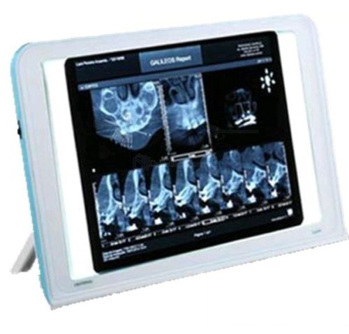 Dental X-Ray Tipo de Cine de Visor de Cajas de la Vista la Pared del LED Iluminado Turística de Montaje Luna