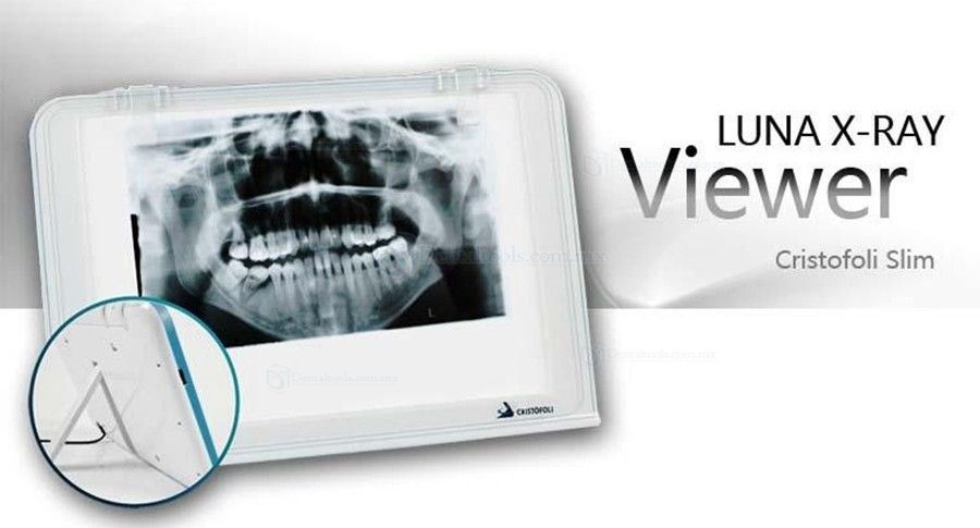 Dental X-Ray Tipo de Cine de Visor de Cajas de la Vista la Pared del LED Iluminado Turística de Montaje Luna