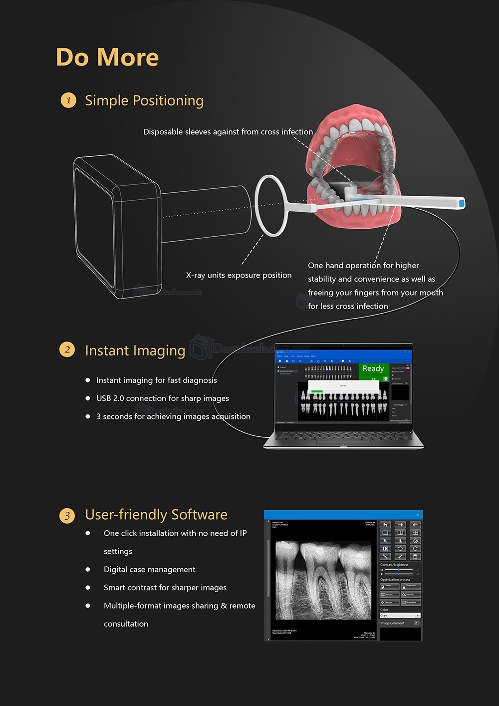 Sensor Digital de Rayos X Dental Sensor Radiográfico Intraoral Sensor RX Dental RVG