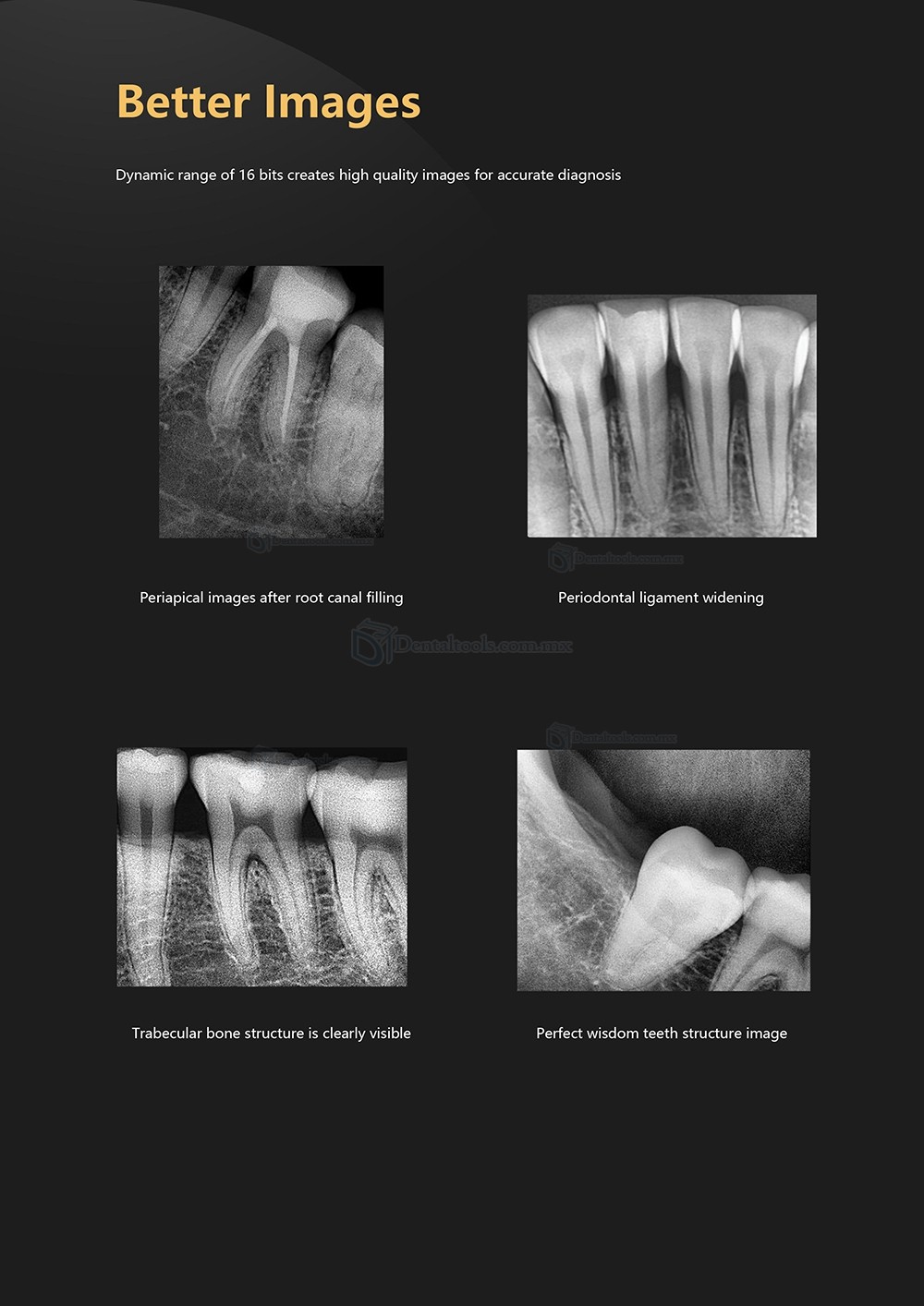 Sensor Digital de Rayos X Dental Sensor Radiográfico Intraoral Sensor RX Dental RVG