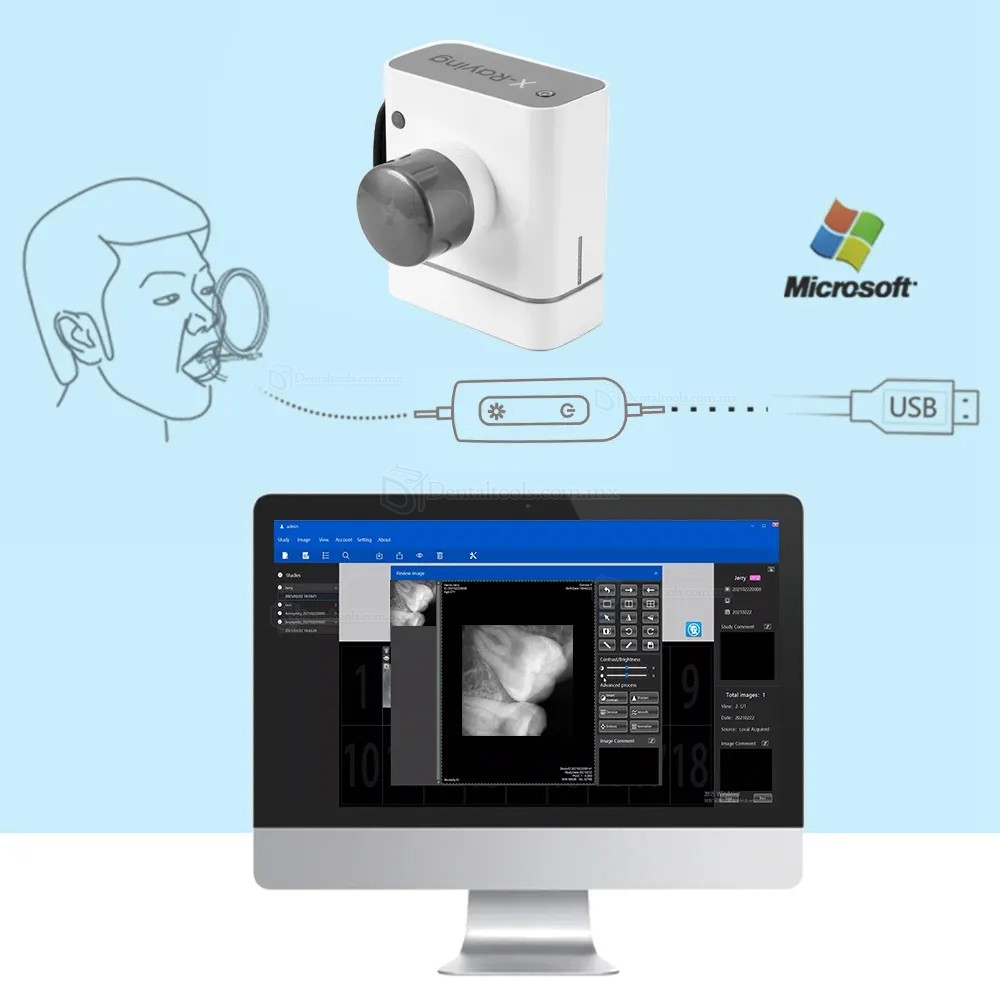 Sensor Digital de Rayos X Dental Sensor Radiográfico Intraoral Sensor RX Dental RVG